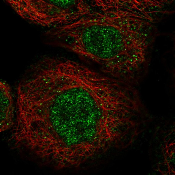 Anti-LYSMD1