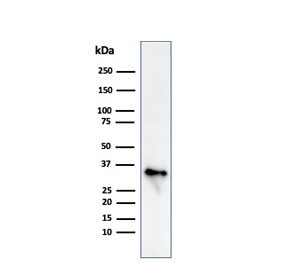 Anti-CD74 / CLIP, clone CLIP/813