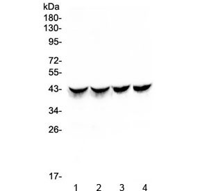 Anti-CTnT / Cardiac Troponin T / TNNT2