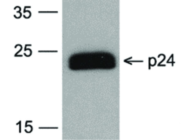 Anti-HIV-1 p24, clone [7F4], Biotin Conjugated