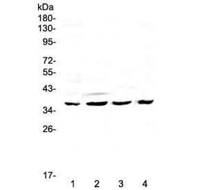 Anti-Cdk6
