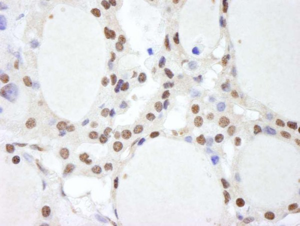 Anti-CSN2 (IHC)