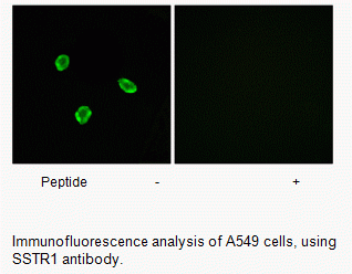Anti-SSTR1