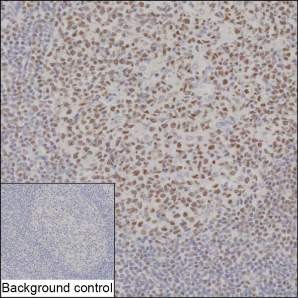 Anti-IKZF3 (recombinant antibody)