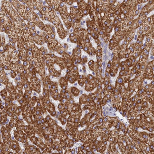 Anti-TMEM30B
