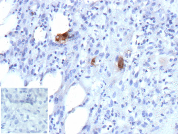 Anti-Cytomegalovirus / UL83, clone r2