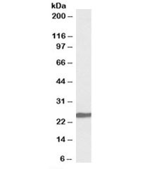 Anti-Neuroblastoma