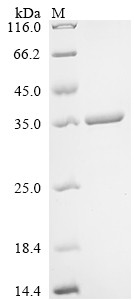 Nuclease P1, Penicillium citrinum, recombinant