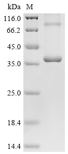 Metalloreductase STEAP1 (Steap1), mouse, recombinant