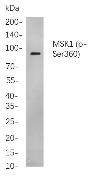 Anti-Recombinant Phospho-MSK1 (Ser360), clone 2B12