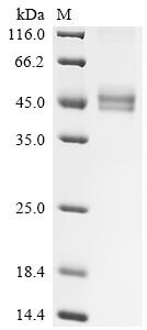 T-cell surface glycoprotein CD3 gamma chain (CD3G), partial, human, recombinant
