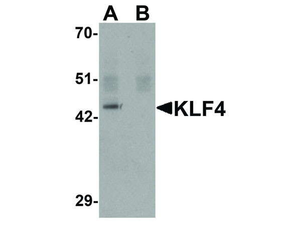 Anti-KLF4, clone [4G6E11]