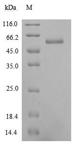 Ephrin-A5 (EFNA5) (Active), human, recombinant
