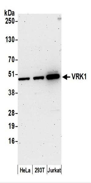 Anti-VRK1