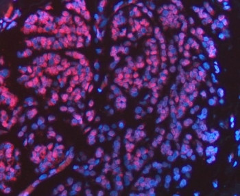 Anti-FIP1L1 / Pre-mRNA 3'-end-processing factor FIP1