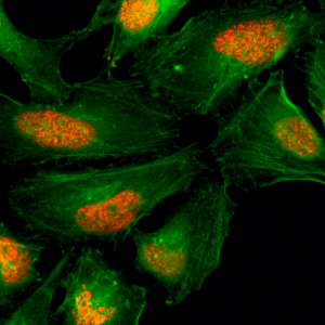 Anti-Histone H2AX, Rabbit Monoclonal (RM214)