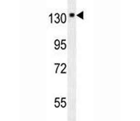 Anti-TrkA / NTRK1, clone 185CT47.6.1