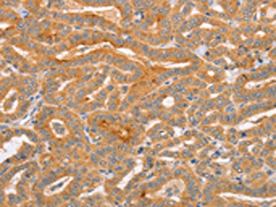 Anti-CD2AP
