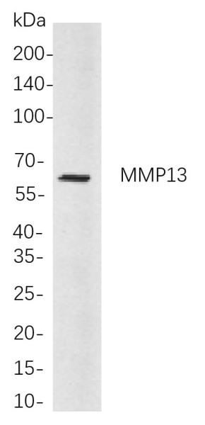 Anti-Recombinant MMP13, clone 8D6