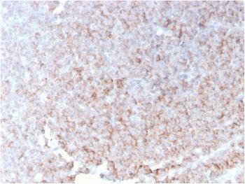 Anti-CD21 (Mature B-Cell &amp; Follicular Dendritic Cell Marker) Monoclonal Antibody (Clone: rCR2/1952)