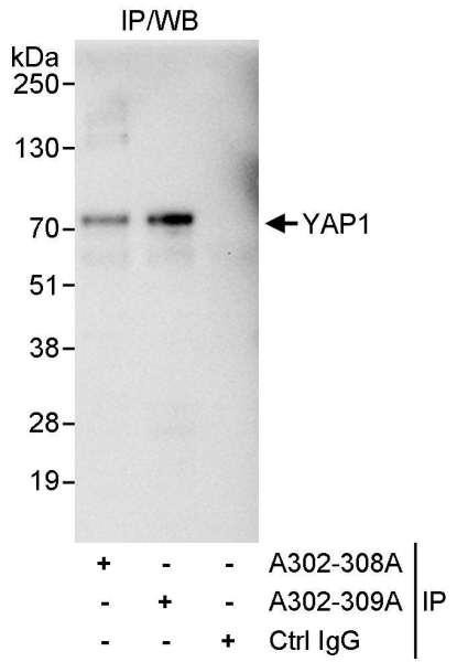 Anti-YAP1