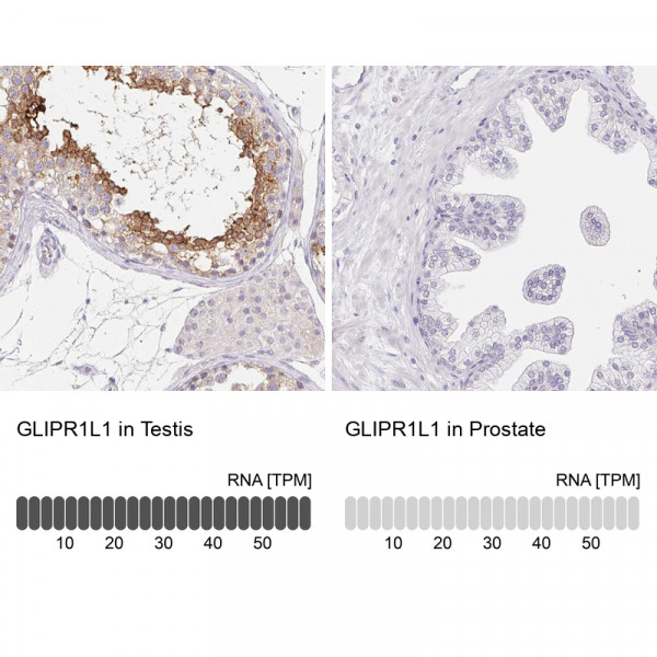 Anti-GLIPR1L1