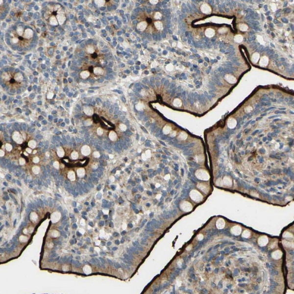 Anti-ARHGAP1