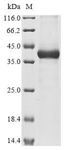 Sterile alpha and TIR motif-containing protein 1 (Ect4), partial, Drosophila melanogaster, recombina