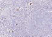 Anti-Endoglin/CD105 Monoclonal Antibody