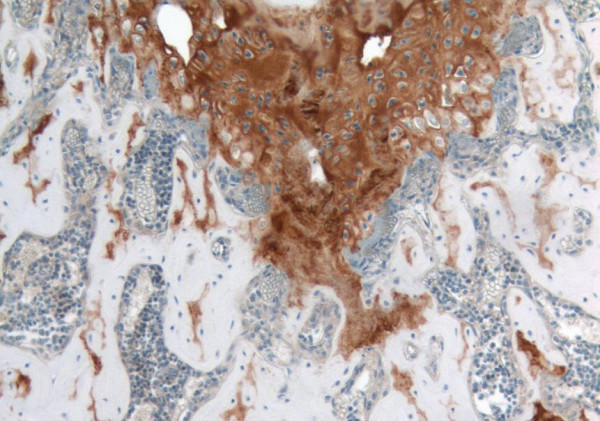 Anti-Collagen II