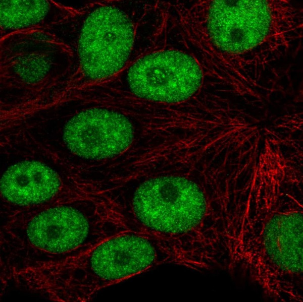 Anti-CD2BP2