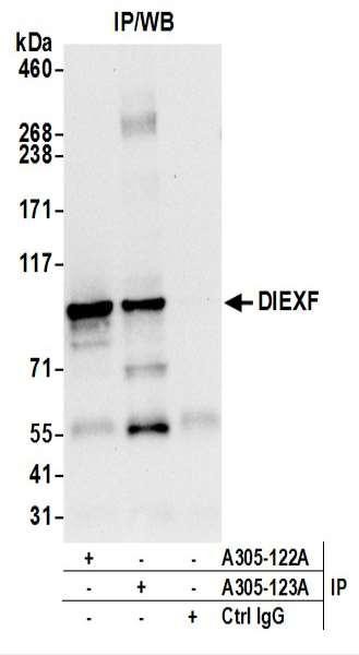 Anti-DIEXF/C1orf107