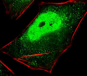 Anti-PSMA5 / Proteasome 19S S5A, clone 426CT8.5.1