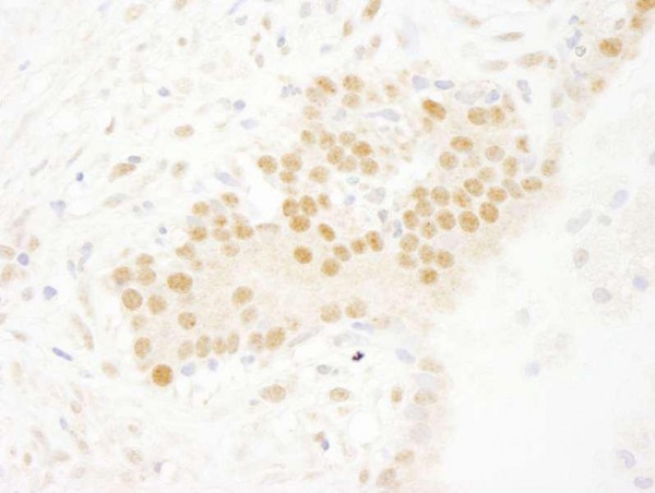 Anti-SET7 (IHC)
