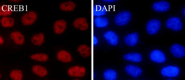 Anti-CREB, clone SQab1877