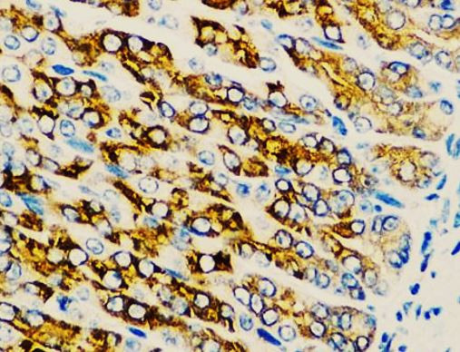 Anti-ACVR1C / ALK7