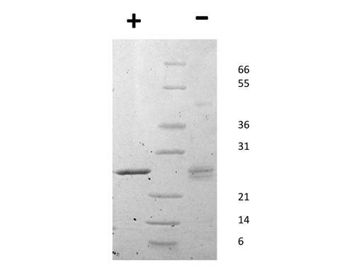 EBI-3