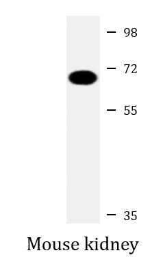 Anti-MGAT4A