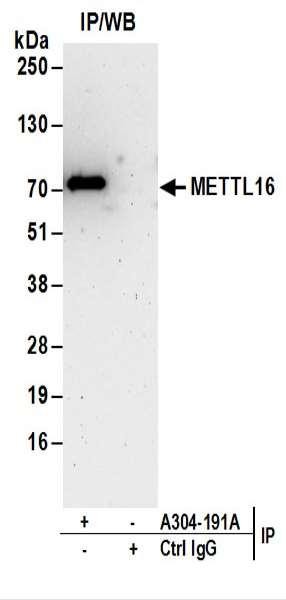 Anti-METTL16