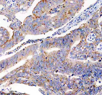 Anti-USP14 / Ubiquitin carboxyl-terminal hydrolase 14, clone ABGI-21