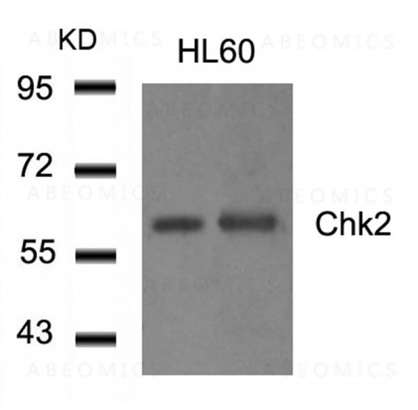 Anti-Chk2 (Ab-516)