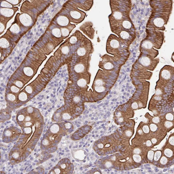 Anti-PTPN3