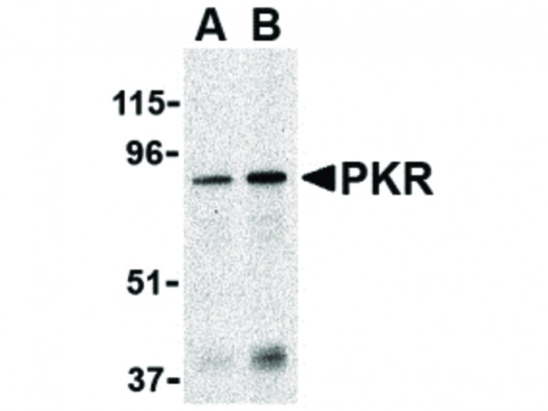 Anti-PKR