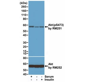 Anti-phospho-AKT (Ser473), clone RM251 (recombinant antibody)