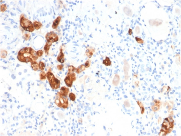 Anti-Calbindin 1 (CALB1), clone CALB1/2782