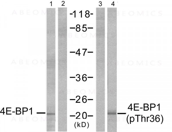 Anti-phospho-4E-BP1(Thr36)