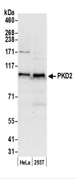 Anti-PKD2