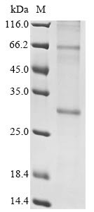 Insulin-induced gene 2 protein (INSIG2), human, recombinant