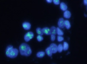 Anti-NPM1, clone 23F1