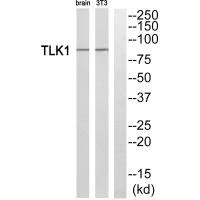 Anti-TLK1